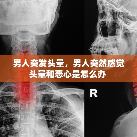男人突发头晕，男人突然感觉头晕和恶心是怎么办 